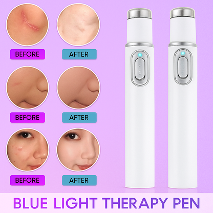 Anti-Varicose Vein Laser Pen